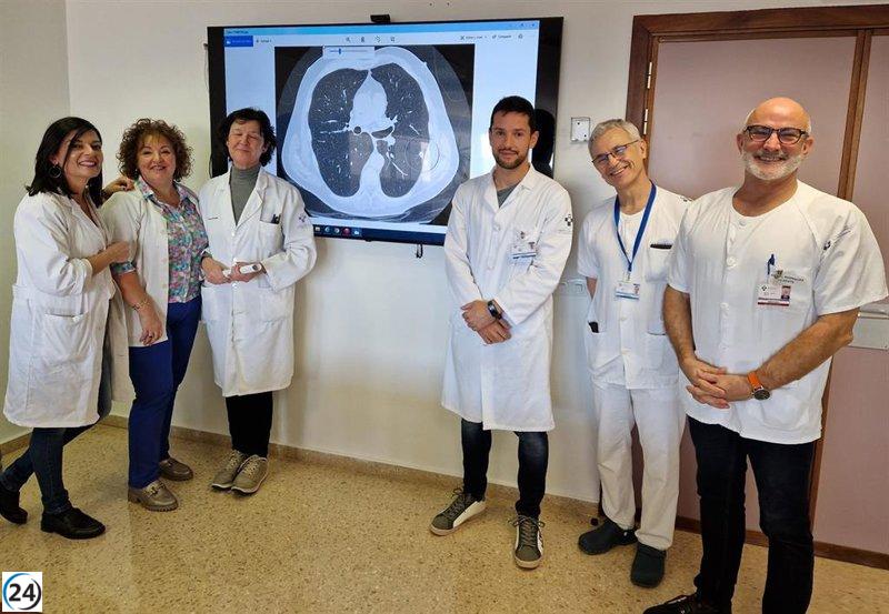 Avilés lanza un programa piloto de detección de cáncer de pulmón con la contratación de 44 nuevos profesionales sanitarios.
